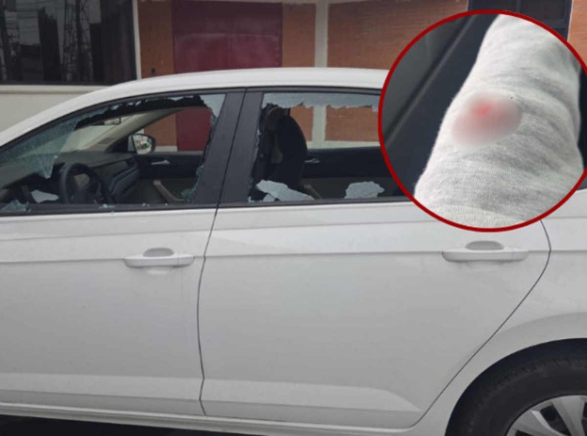 Hieren de bala a funcionaria de Tecámac