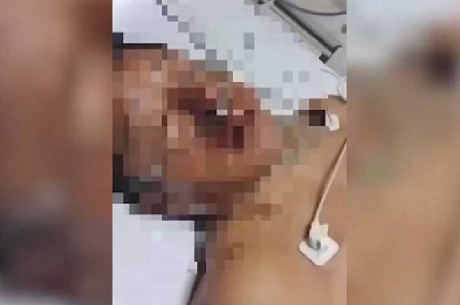 #Video: "Era un niño" el que disparó al alcalde de #ValleDeChalco, relata el particular