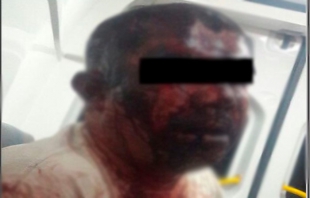 ﻿Turba da golpiza a hombre que agredió a otro en Tepetlaoxtoc