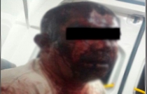 ﻿Turba da golpiza a hombre que agredió a otro en Tepetlaoxtoc