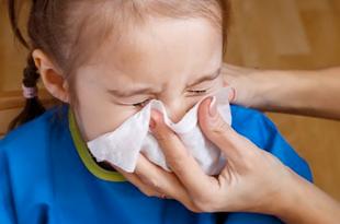 El virus sincital es una enfermedad viral considerada como común y que causa síntomas leves similares al resfriado.