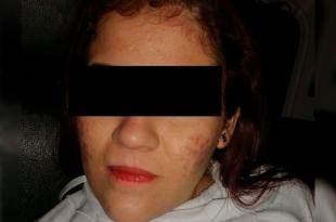 Se detuvo a Odalis "N" de 19 años, quien acorde a las primeras indagatorias podría pertenecer a la delincuencia organizada.